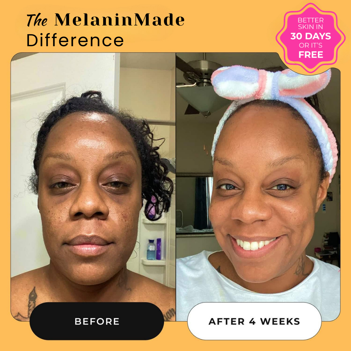 MelaninMade™ Overnight Dark Spot Remover