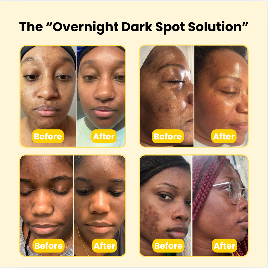 MelaninMade™ Overnight Dark Spot Remover