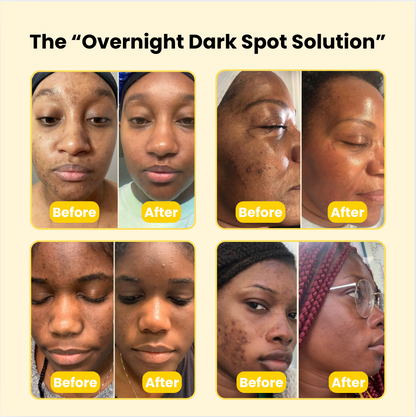 MelaninMade™ Overnight Dark Spot Remover